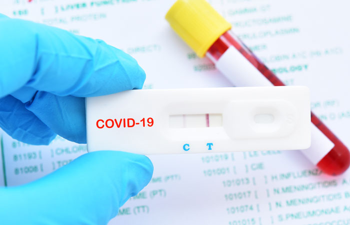 Coronavirus Test PCR test de antígenos test de anticuerpos de