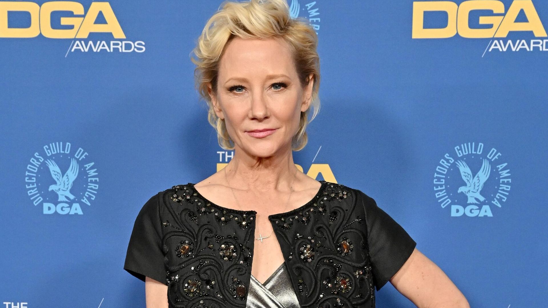 Anne Heche en condición crítica; aseguran que no sobrevivirá