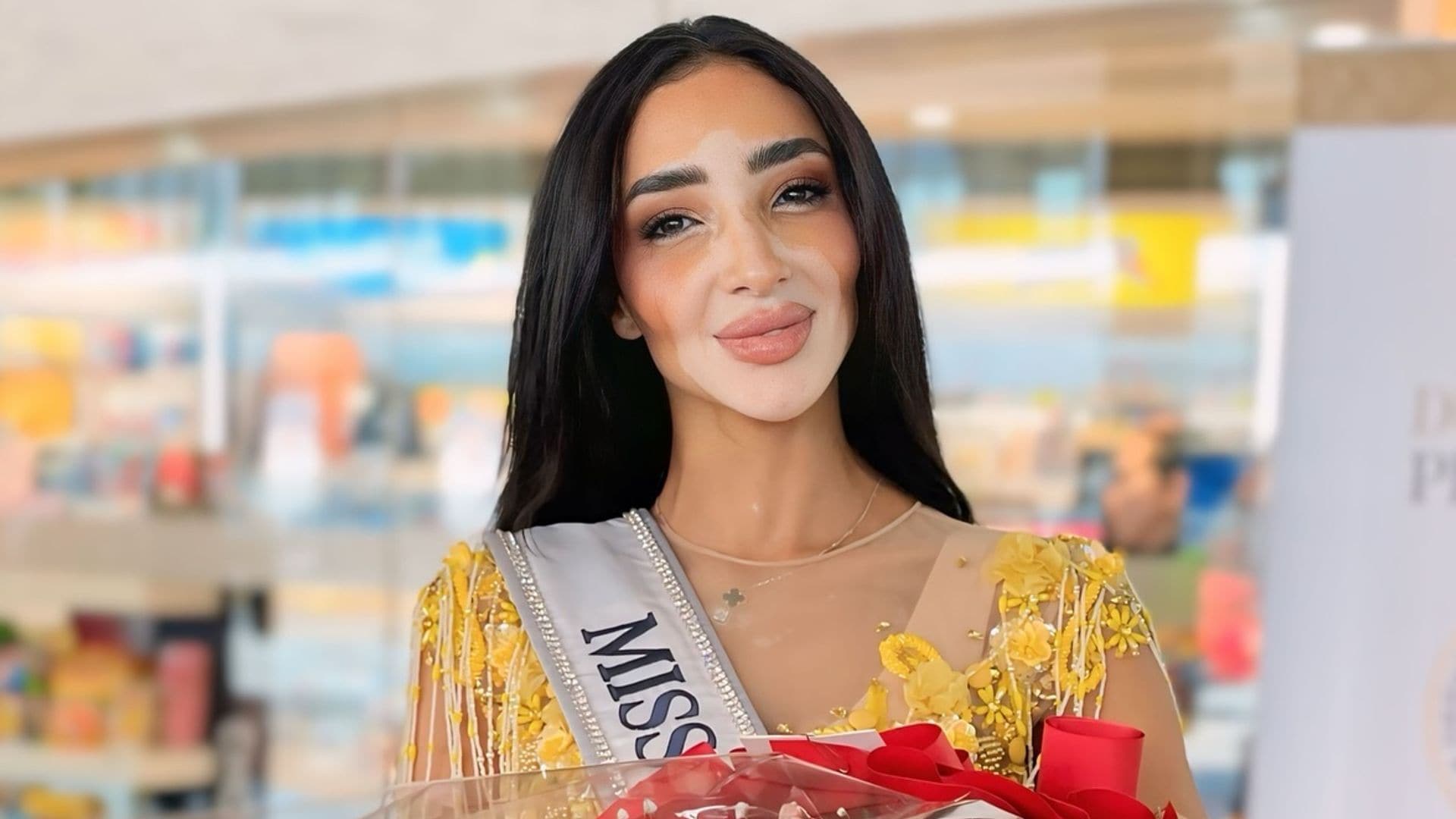 Logina Salah, la primera concursante de Miss Universe con vitíligo: ‘Me ha hecho una persona mucho más fuerte’