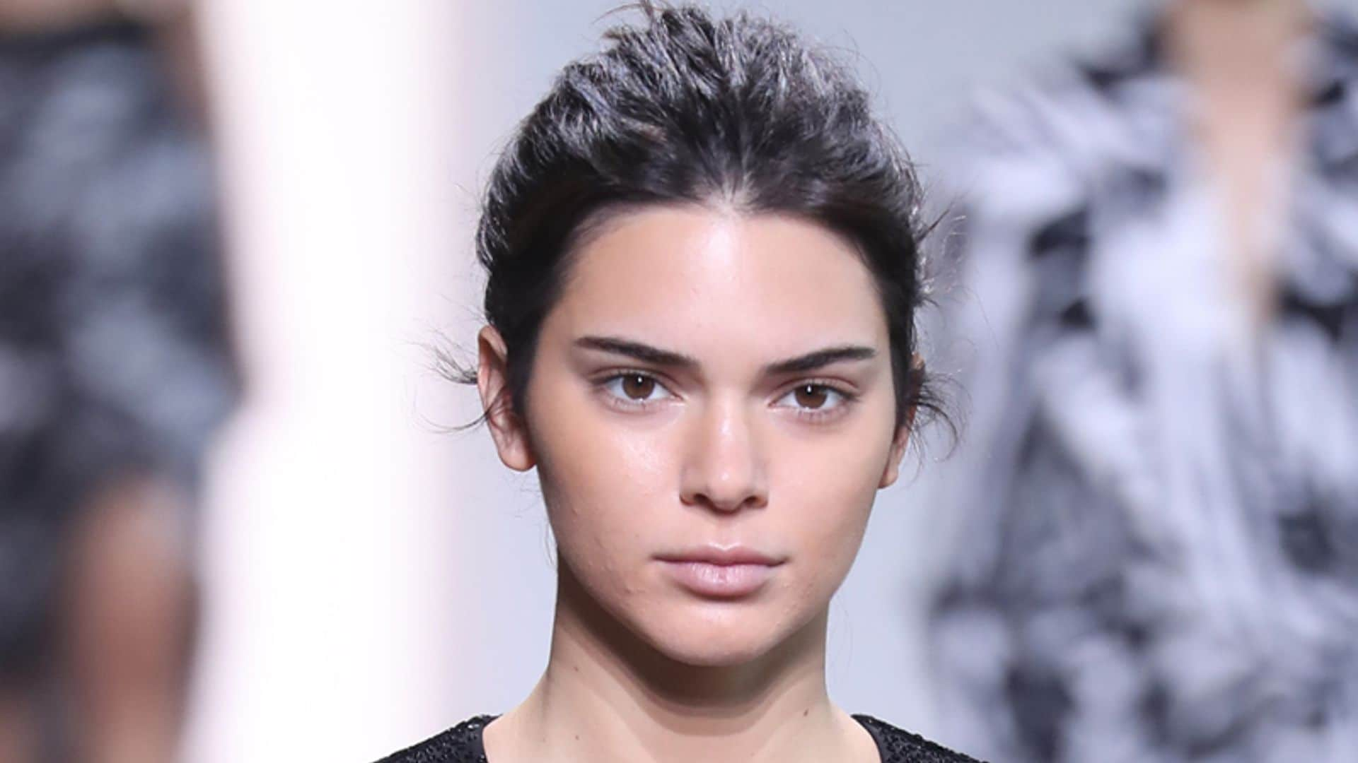 ¿Sufres acné como Kendall Jenner? Di adiós a tu problema con estas tres mascarillas caseras