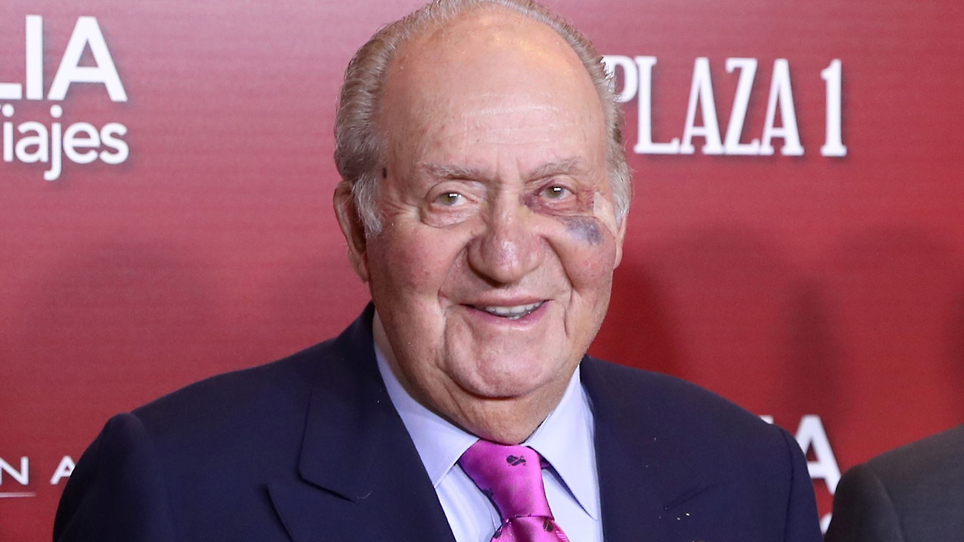 Don Juan Carlos, intervenido de una lesión cutánea por sobreexposición al sol