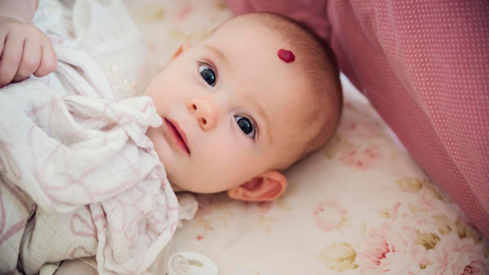 ¿Son peligrosas las manchas en la piel del recién nacido?