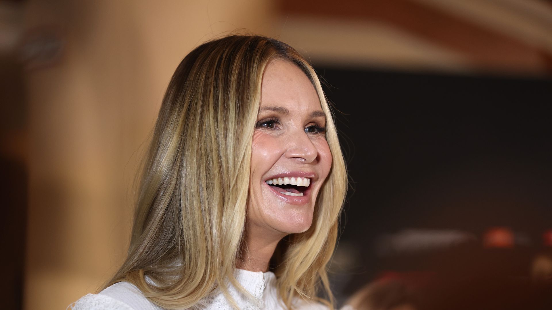 Así funciona el lifting sin cirugía que ha conectado a Elle Macpherson y Mar Flores