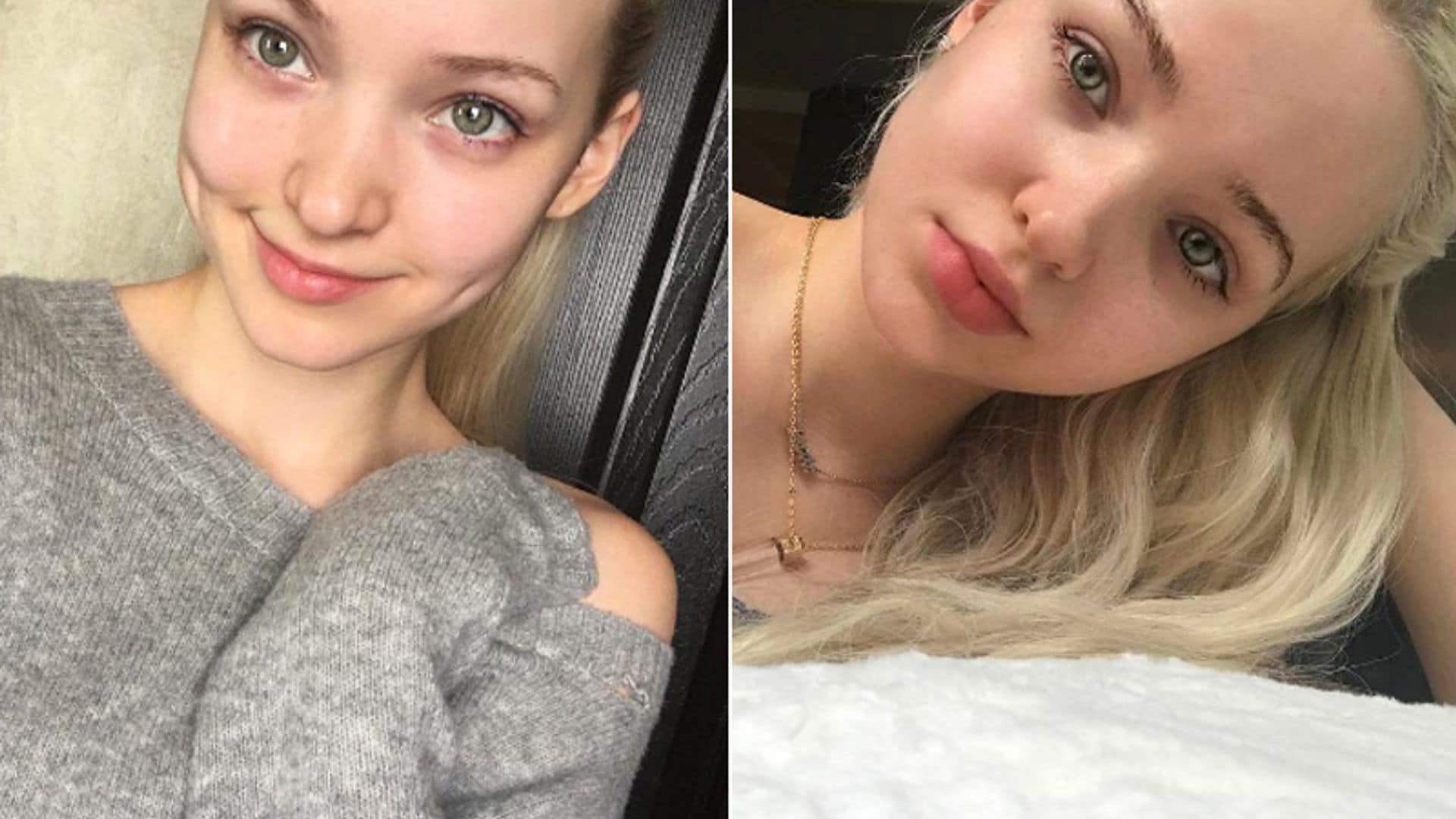 Dove Cameron sin maquillaje: consejos para tener una piel perfecta