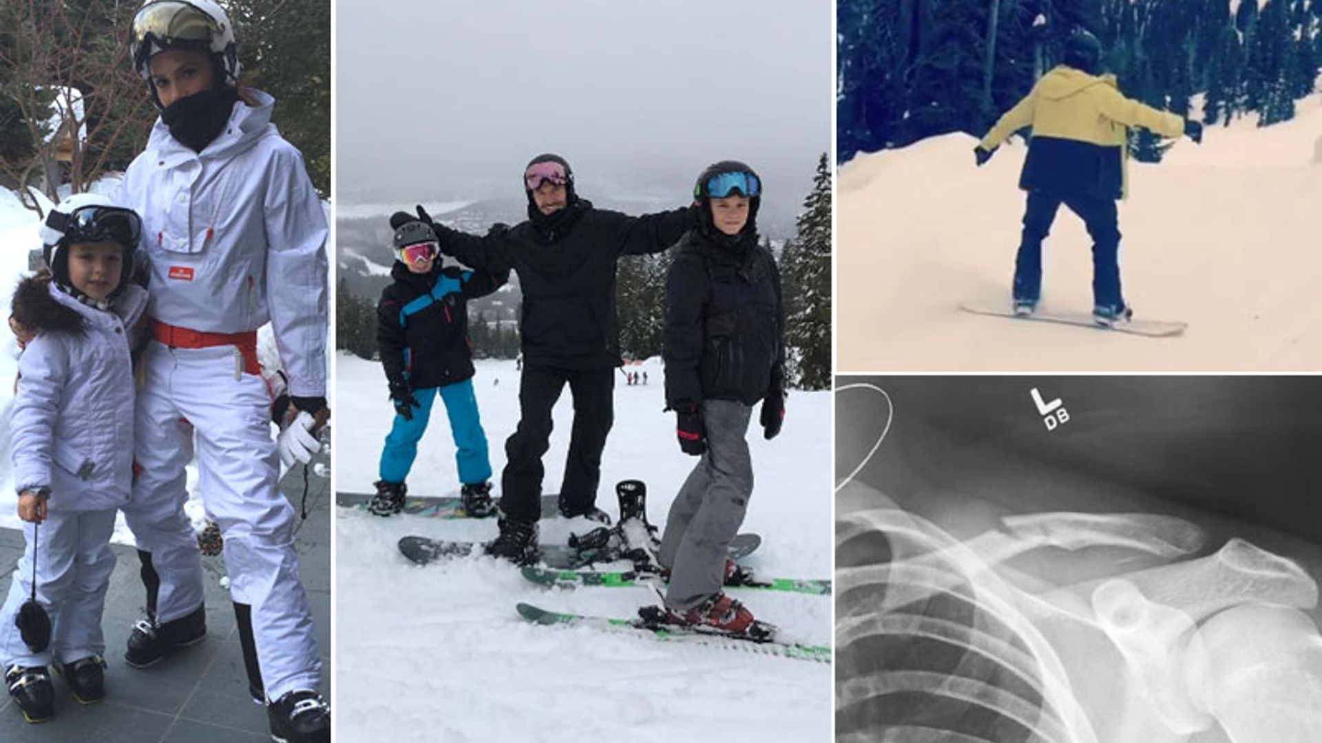 El accidente de Brooklyn Beckham mientras practicaba 'snowboard' en sus idílicas vacaciones familiares