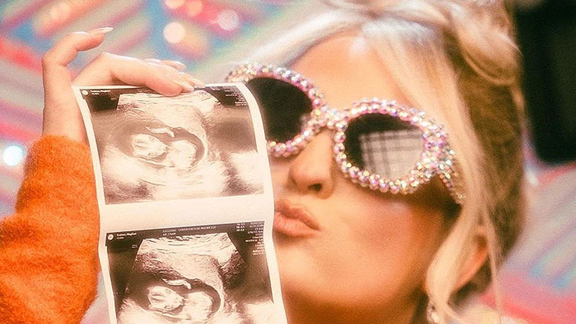 ¡La familia vuelve a crecer! Meghan Trainor anuncia que está embarazada de su segundo hijo