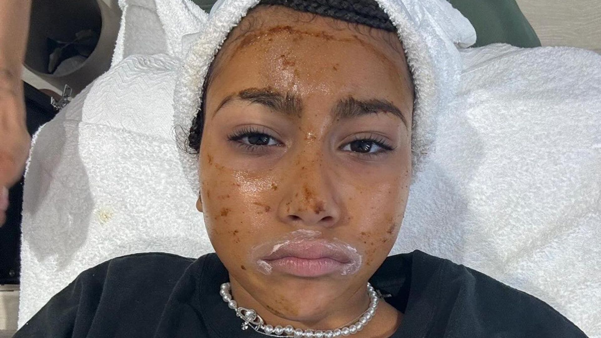 Los riesgos de que una niña, como North West, se someta a un tratamiento facial