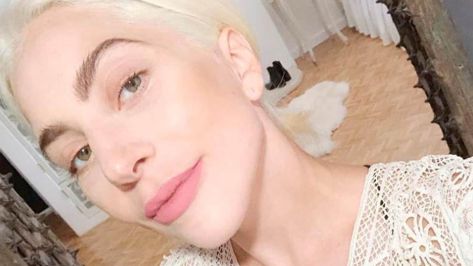 Lady Gaga al descubierto: sus trucos para lucir una piel saludable ¡sin maquillaje!