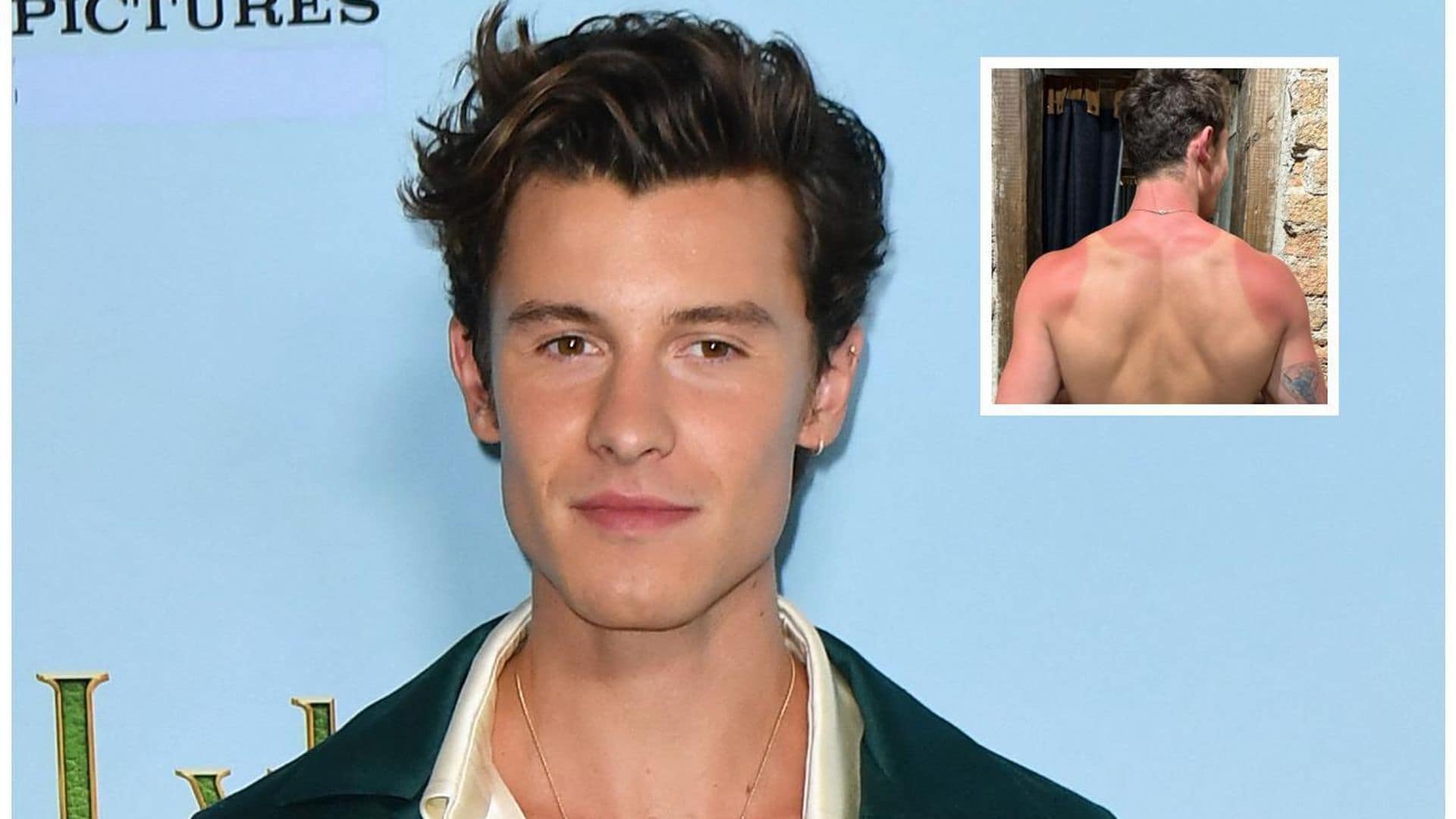 Shawn Mendes sufre quemaduras en la espalda durante su visita a las pirámides en México