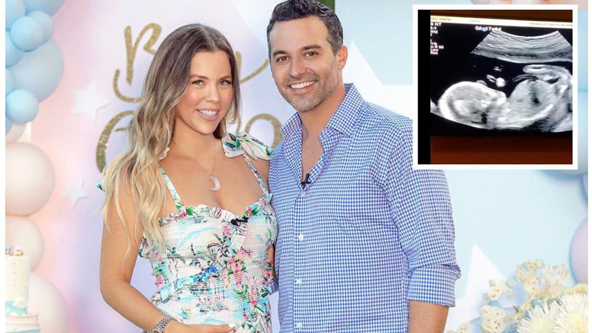 Ximena Duque y Jay Adkins comparten el ultrasonido de su bebé