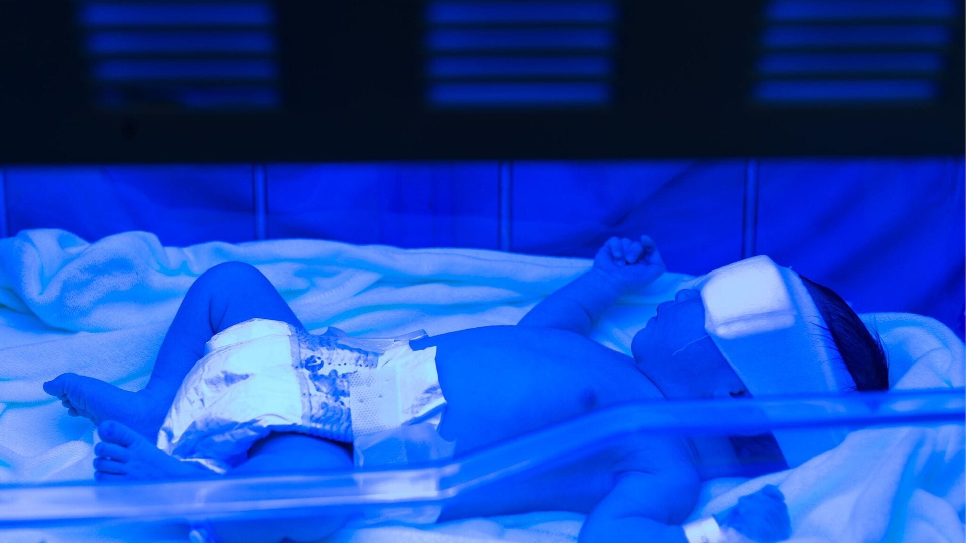 Fototerapia por ictericia en recién nacidos: ¿qué es y cómo es el tratamiento?
