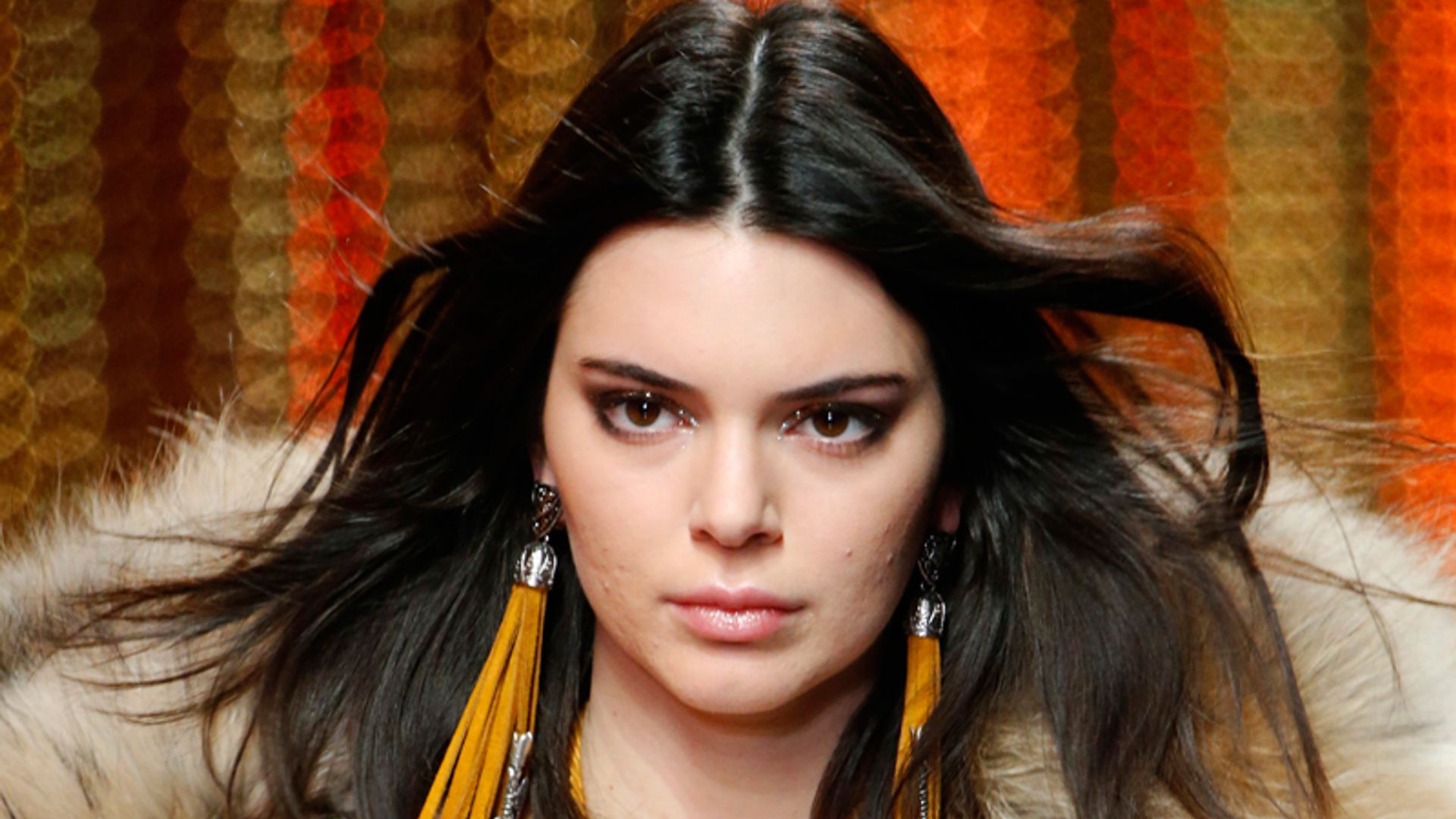 No estás sola Kendall Jenner, estas 'celebrities' también sufren problemas de acné