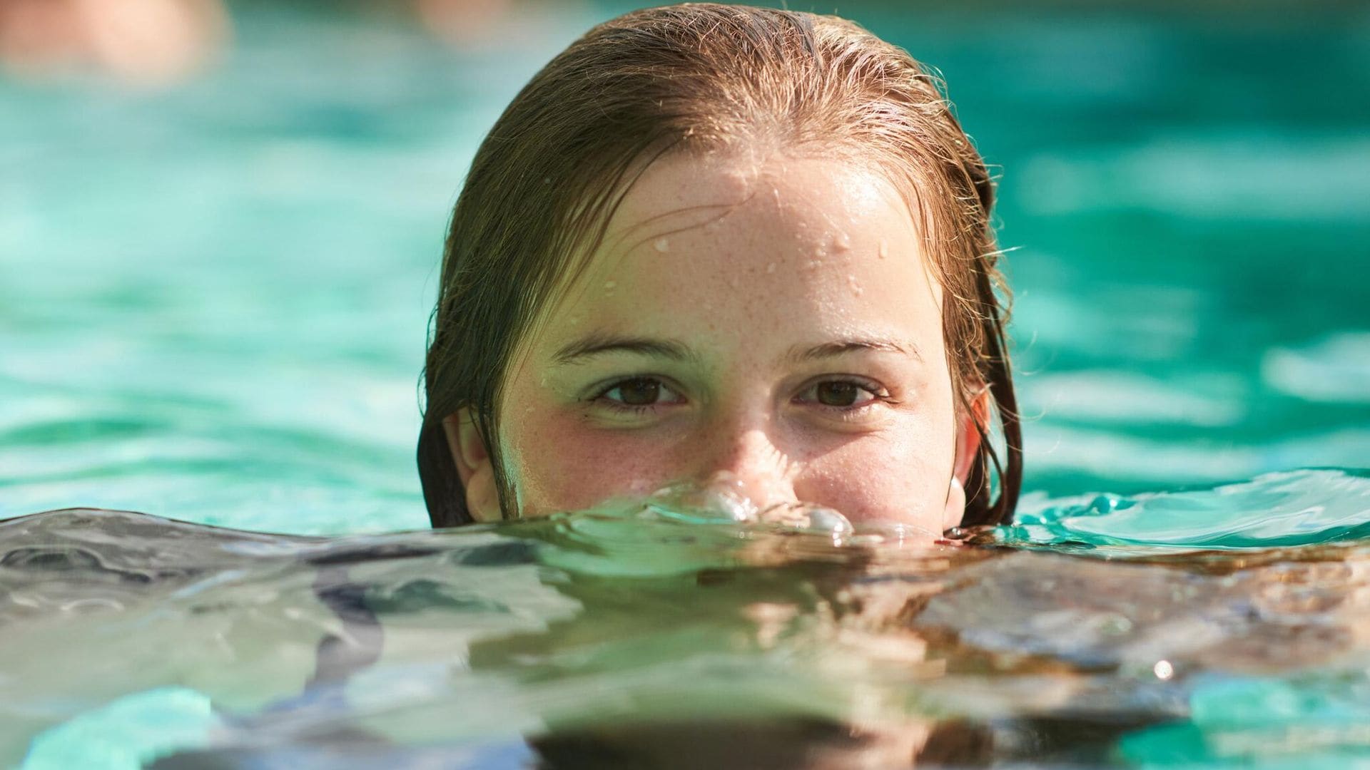 Acné de verano en adolescentes: así les afecta el sol y el agua del mar