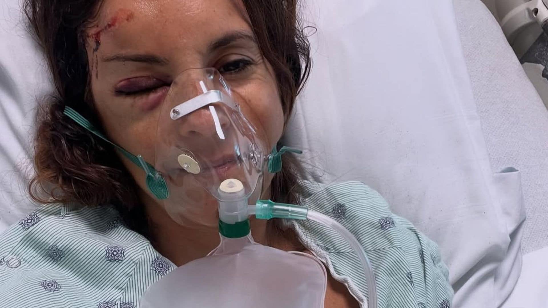 La impactante imagen de la mujer del expiloto de F1 Romain Grosjean tras sufrir un grave accidente