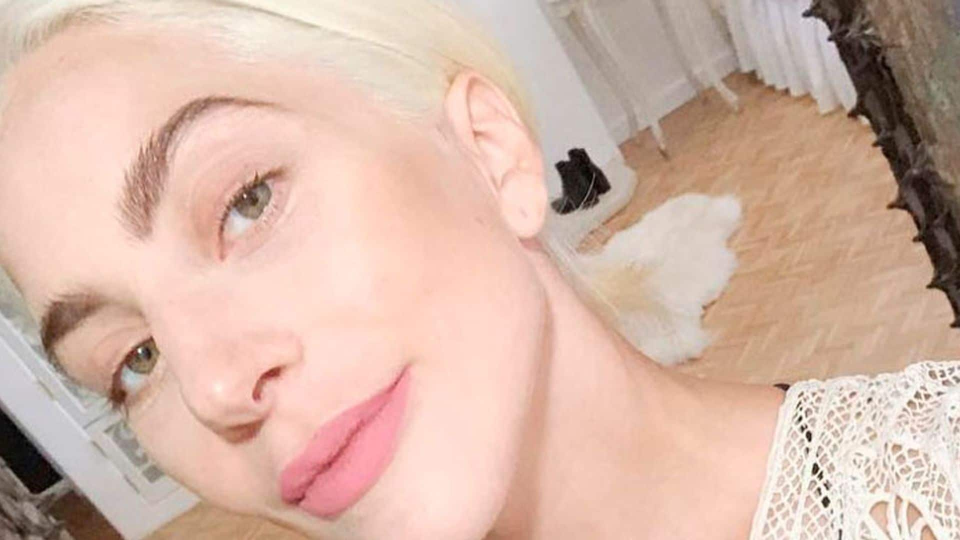 Lady Gaga al descubierto: sus trucos para lucir una piel saludable ¡sin maquillaje!