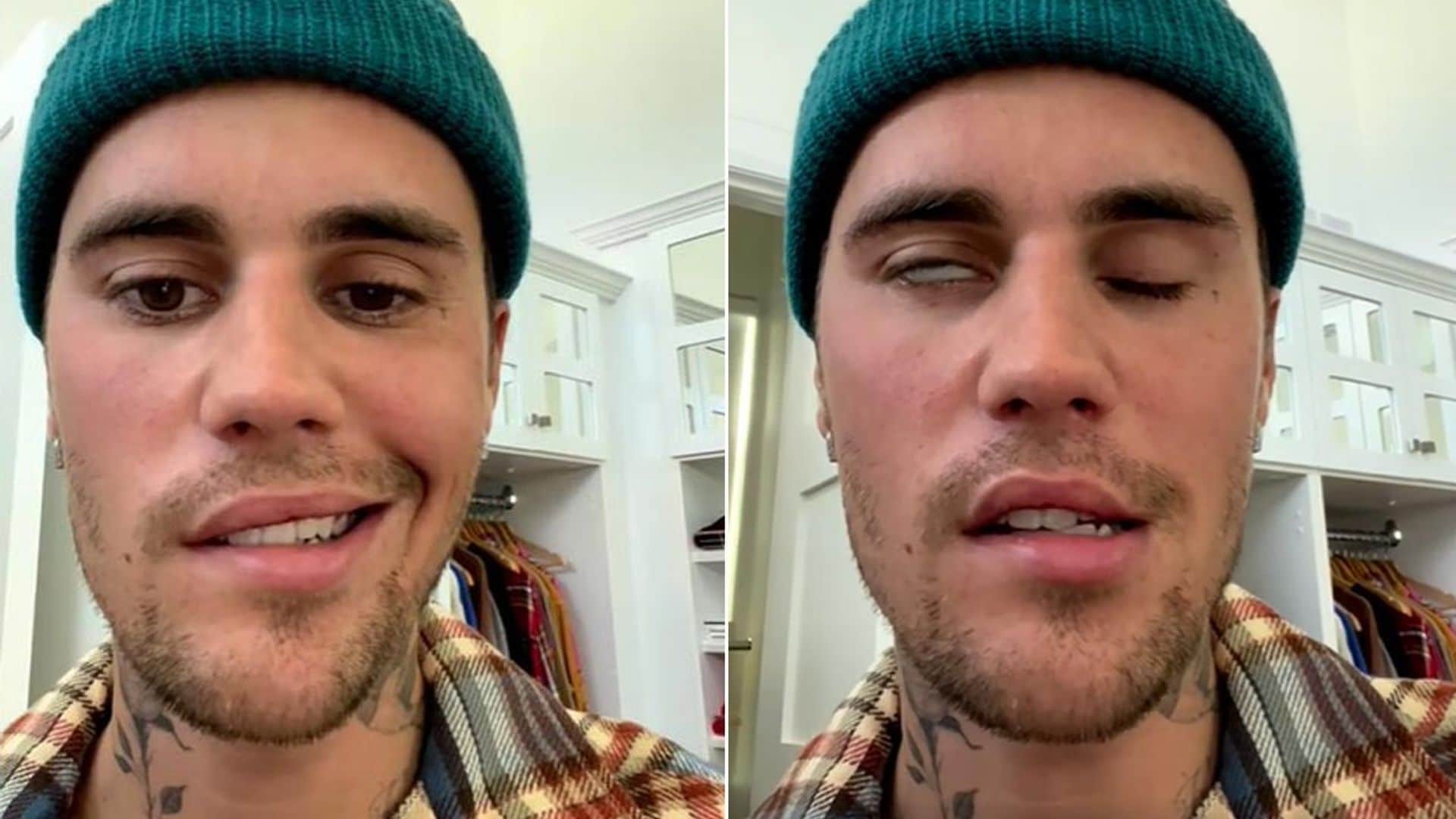 Las imágenes de la parálisis facial de Justin Bieber que le ha obligado a cancelar sus conciertos