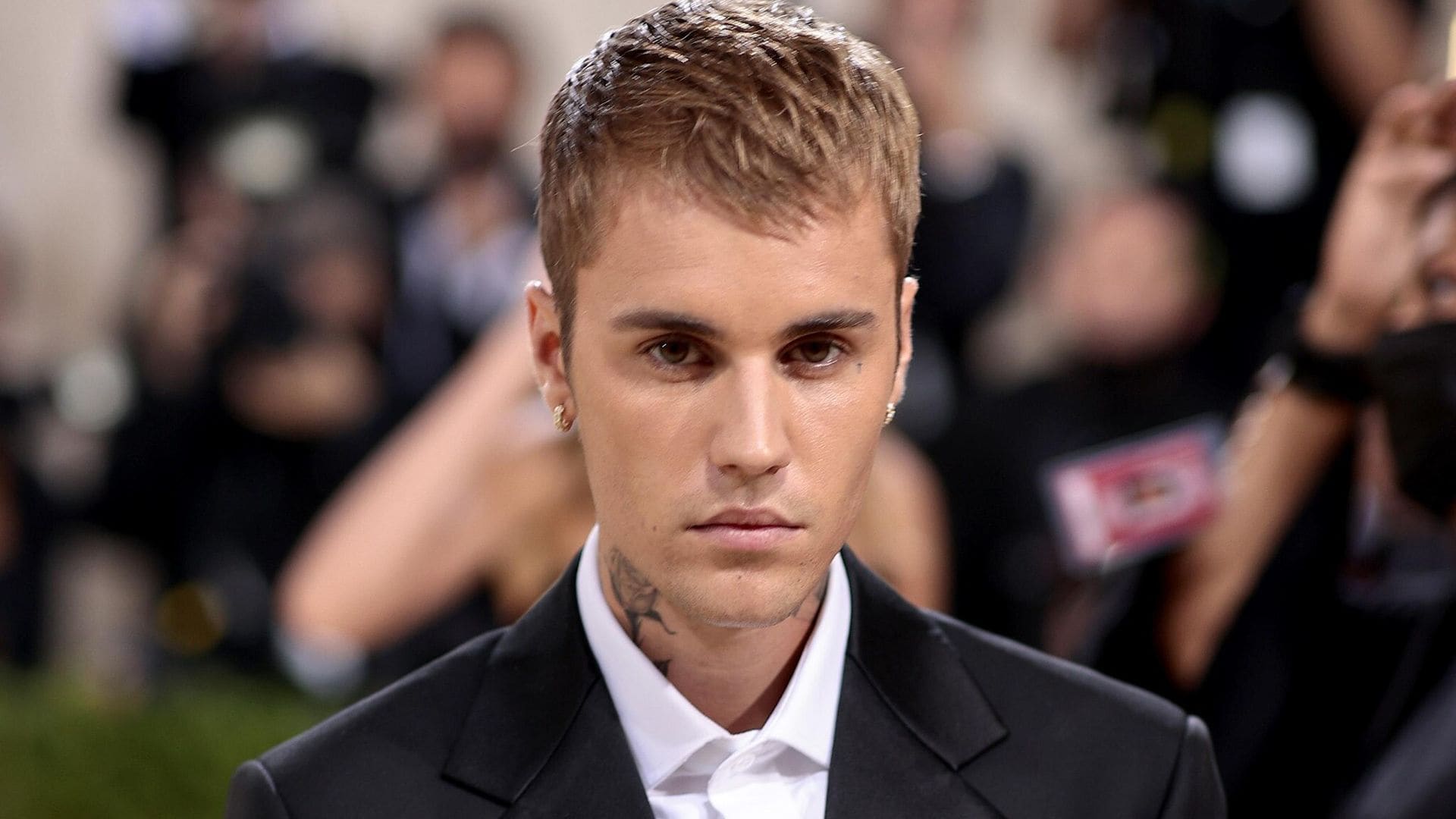 Justin Bieber pide oraciones por su salud y revela que tiene el rostro paralizado