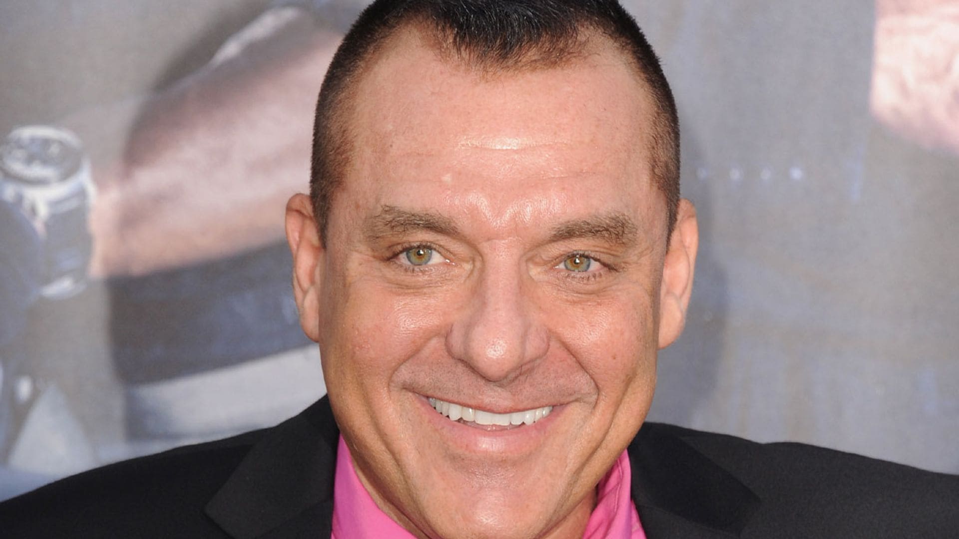 ¿Qué es el aneurisma cerebral por el que el actor Tom Sizemore está en estado crítico?