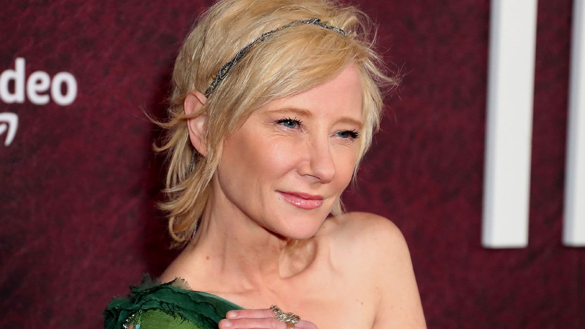 Anne Heche está en coma y sufre graves quemaduras en el cuerpo tras su accidente de coche