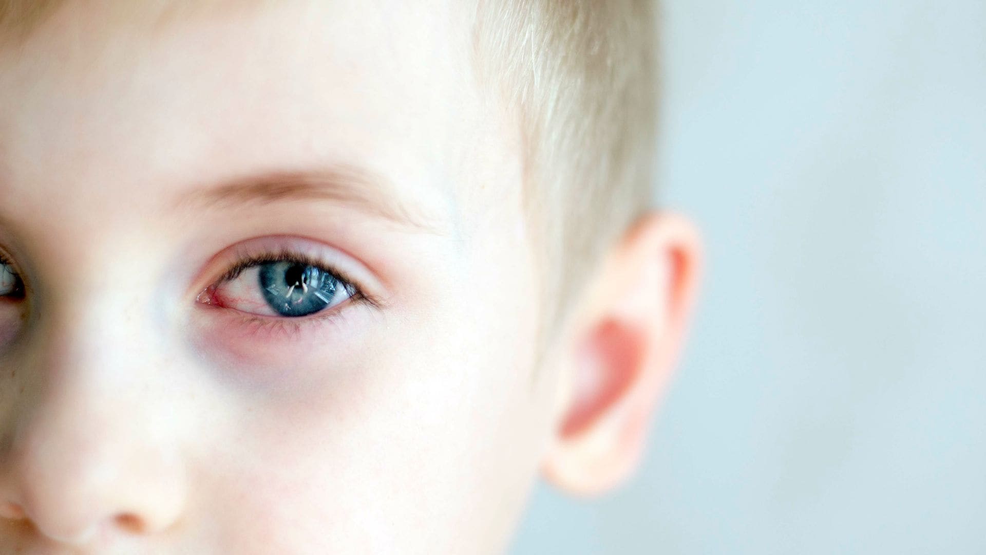 ¿Cómo diferenciar la conjuntivitis de los mocos en los ojos de los niños?