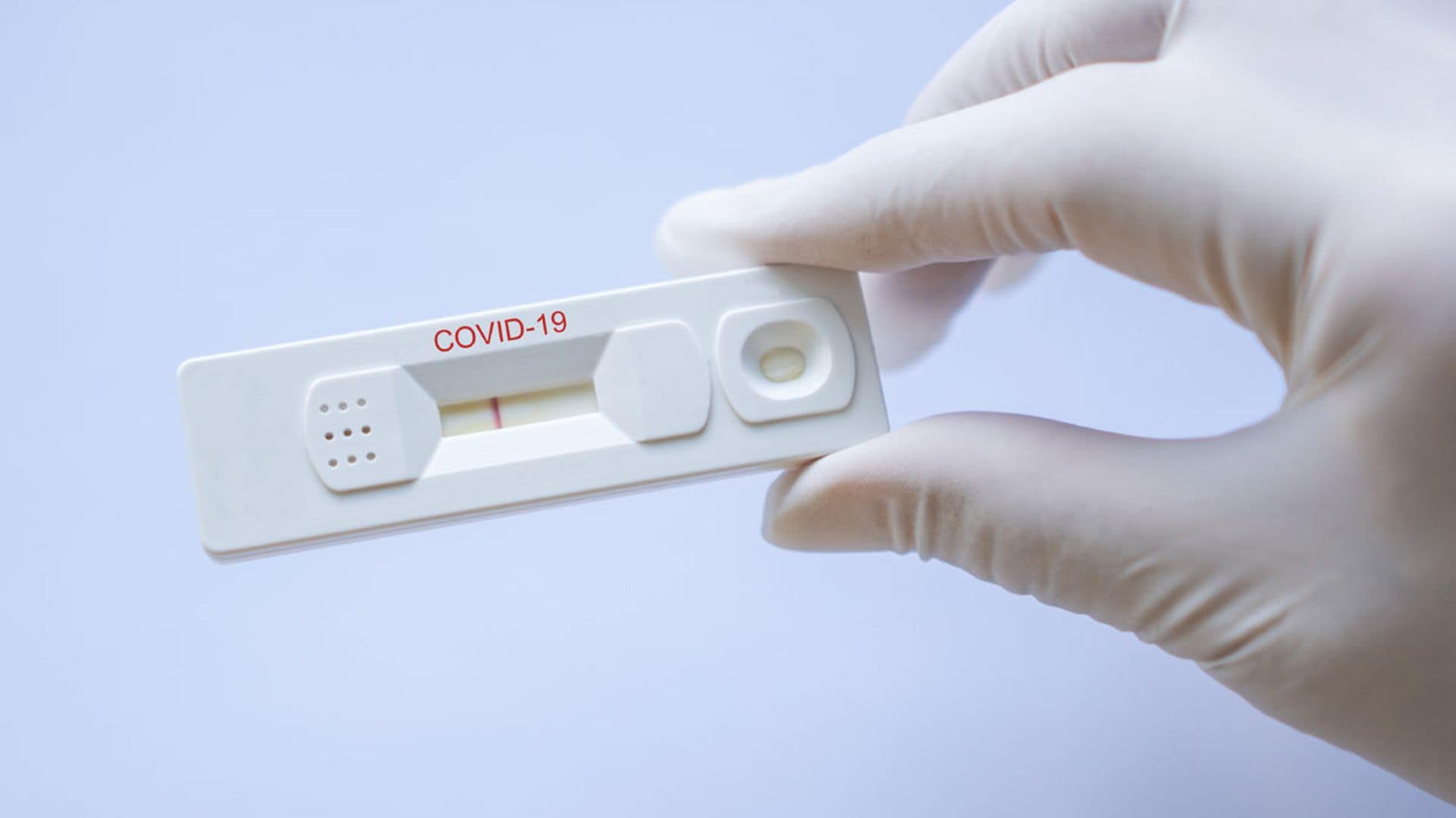 ¿Cómo puedo saber si he pasado la Covid-19?