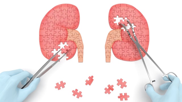 linfoma renal