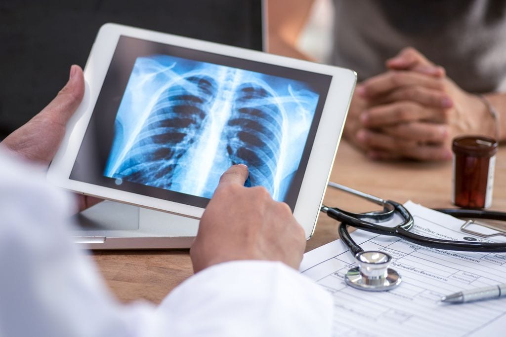 doctor viendo el resultado de un escáner pulmonar en una tablet