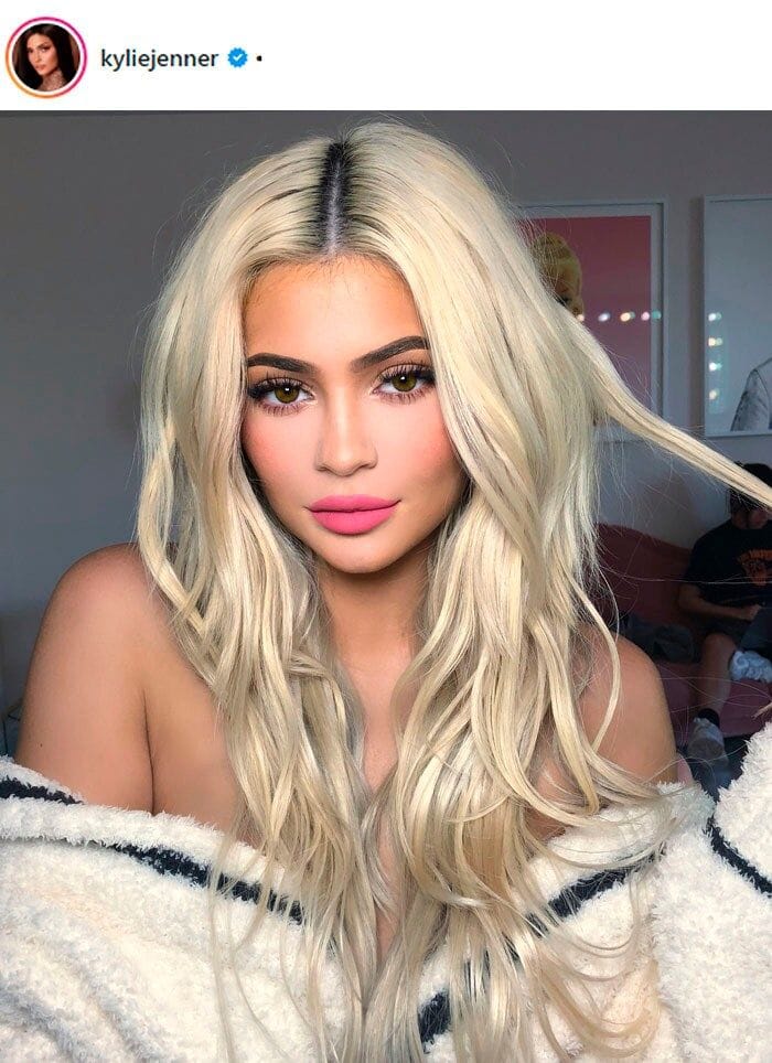 kylie-jenner-labios-relleno-ig-despues