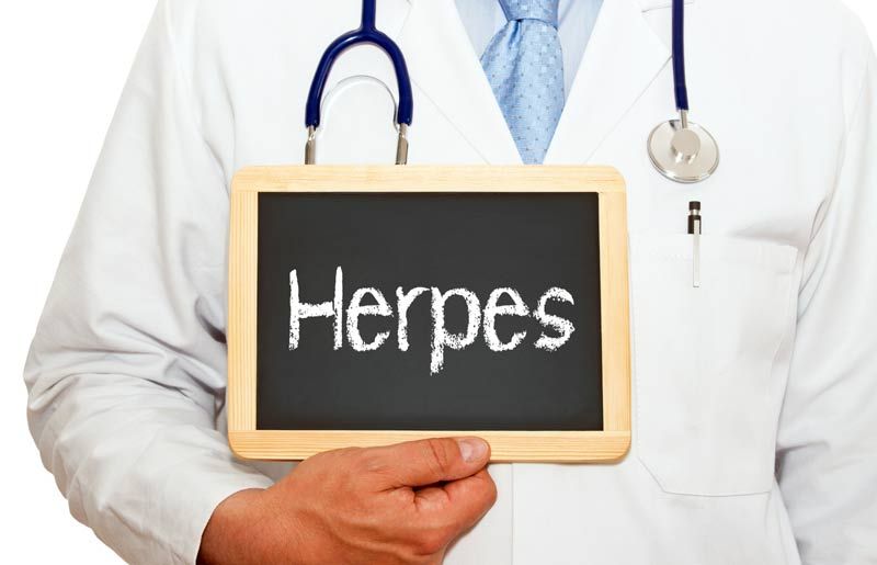 herpes