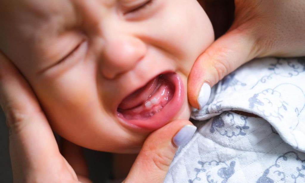 beb con dolor de dientes