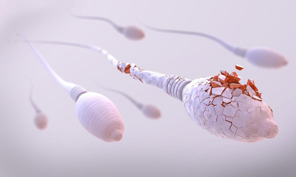 qu alteraciones afectan a los espermatozoides 