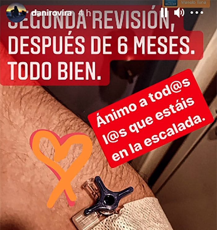 Dani Rovira muestra que 'todo va bien' en su recuperación contra el cáncer