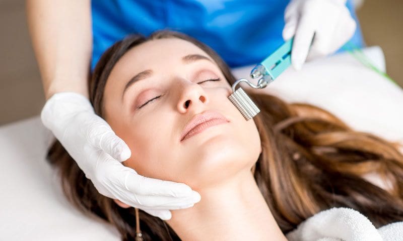 microneedling