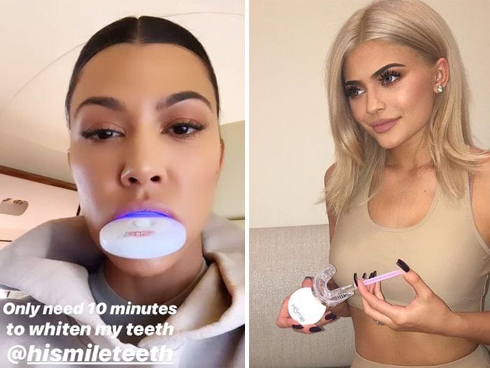 Georgina Rodríguez utiliza el producto favorito de las 'celebs' para blanquear sus dientes