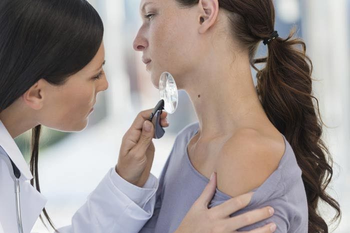 mujer revisándose un lunar en el dermatólogo