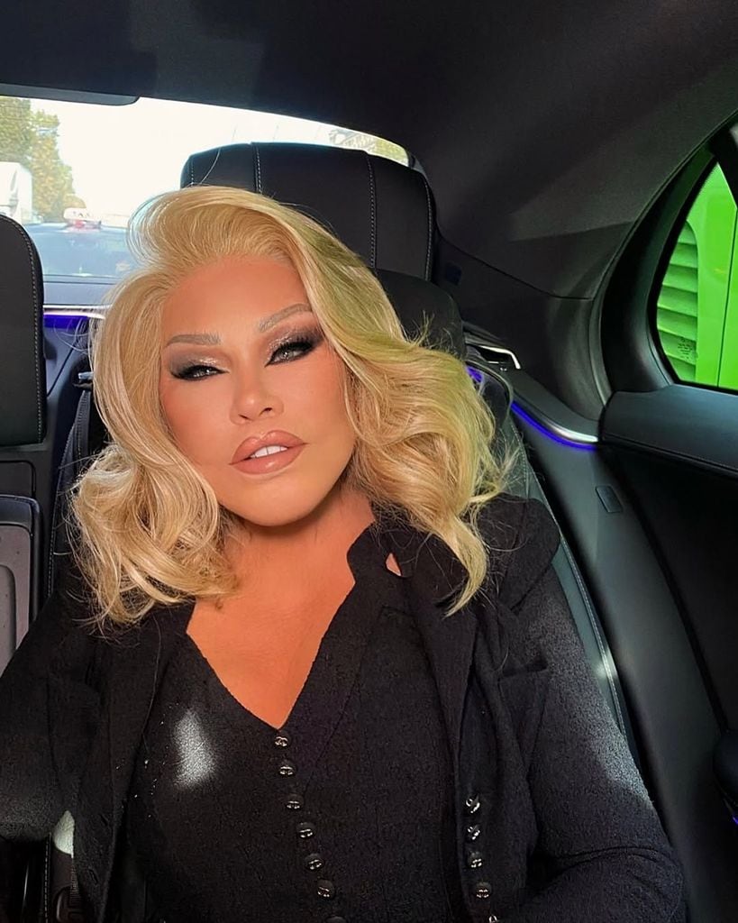 "Muere Jocelyn Wildenstein, la 'Catwoman' de la jet set famosa por sus extremas cirugías estéticas"