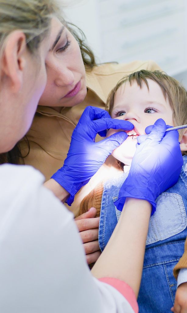 Caries severa en la primera infancia