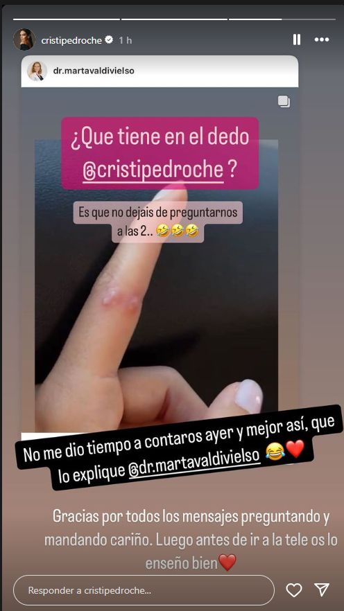 Cristina Pedroche enseña su lesión en el dedo