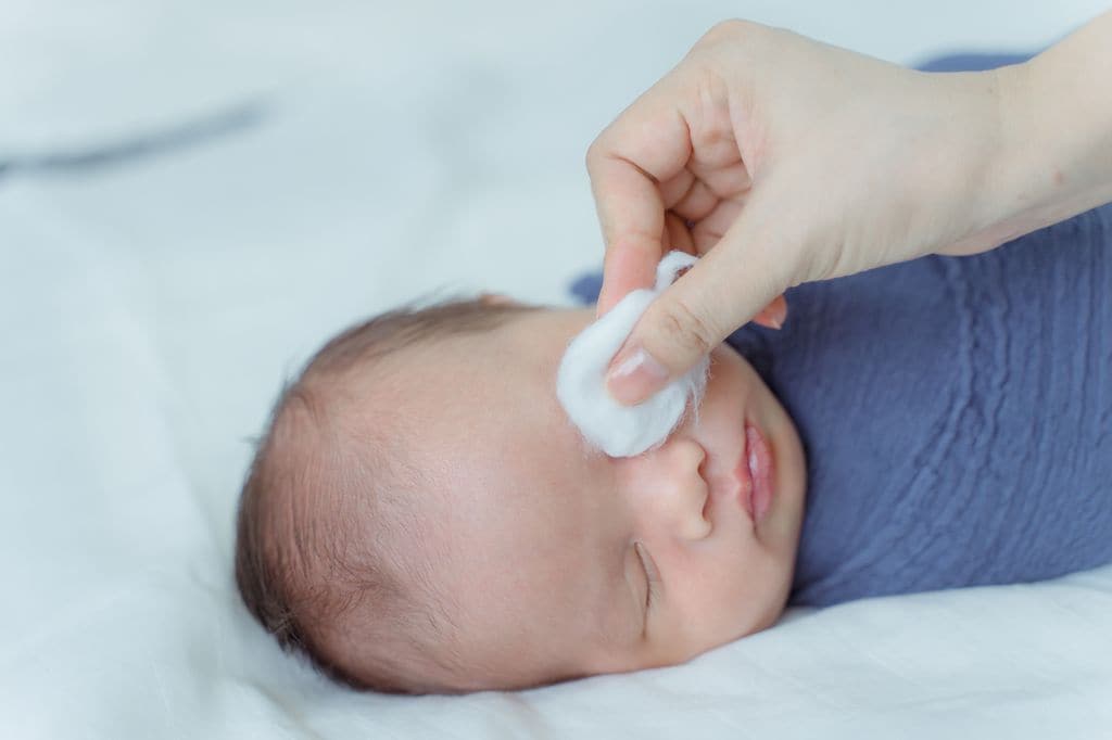 Limpieza de ojos con una gasa en bebé con conjuntivitis