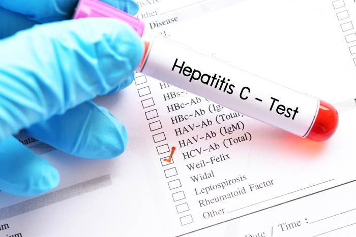 hepatitis C test