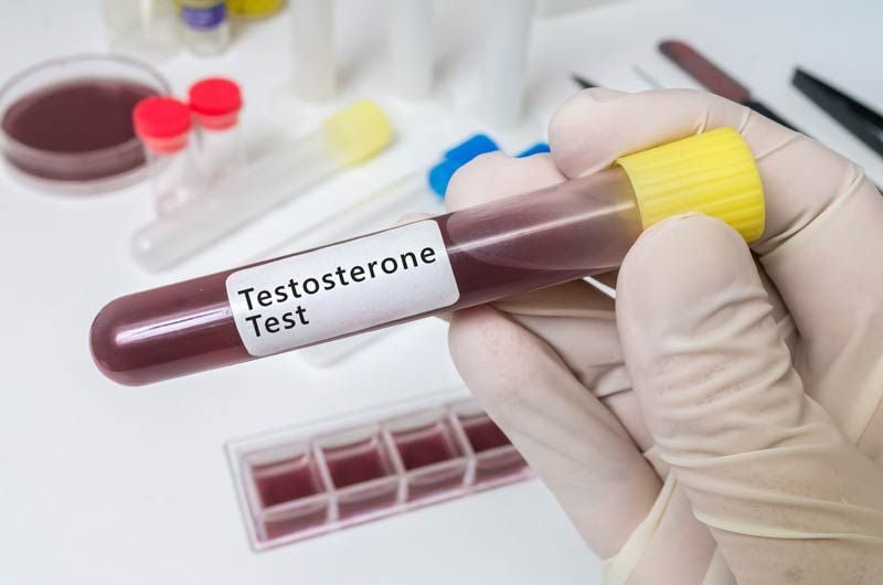 test testosterona