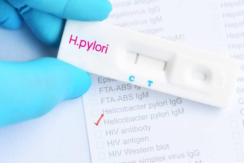 helicobacter pylori diagnos