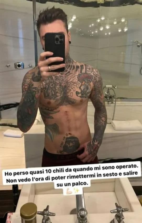 El rapero Fedez muestra su cambio físico tras su operación de páncreas