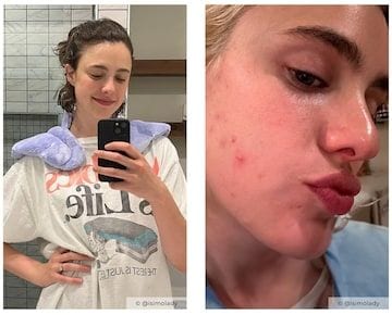 Margaret Qualley sufrió de acné durante la filmación de "La Sustancia"