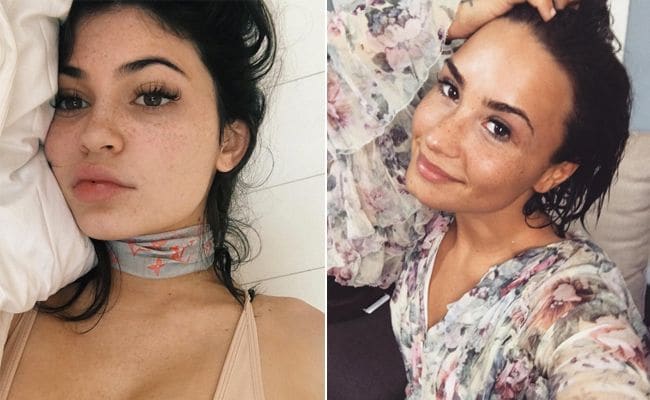 celebrities que ocultan sus pecas