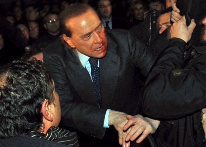 Silvio Berlusconi es agredido por un hombre con problemas mentales