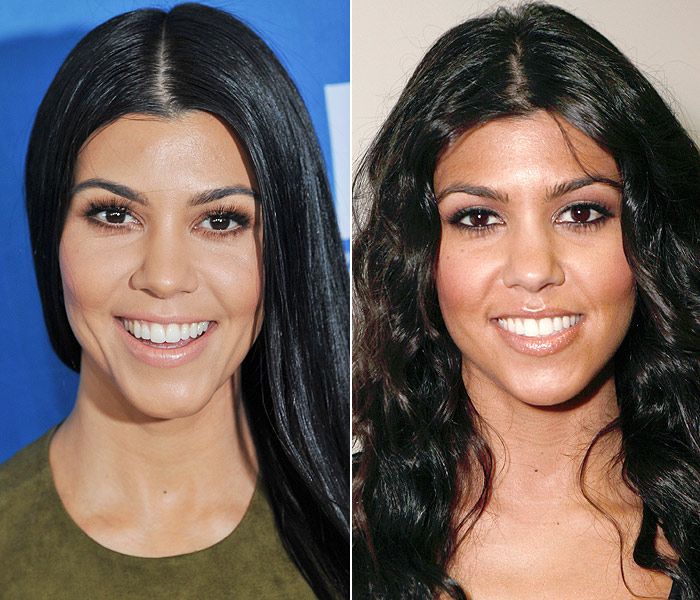 El antes y el después de Kourtney Kardashian, quien para los expertos es, junto a Kim, la que mejor tratada está. "No porque no se aprecie un cambio considerable sino porque tienen todos los rasgos más armónicos", asegura la Dra. Mira
