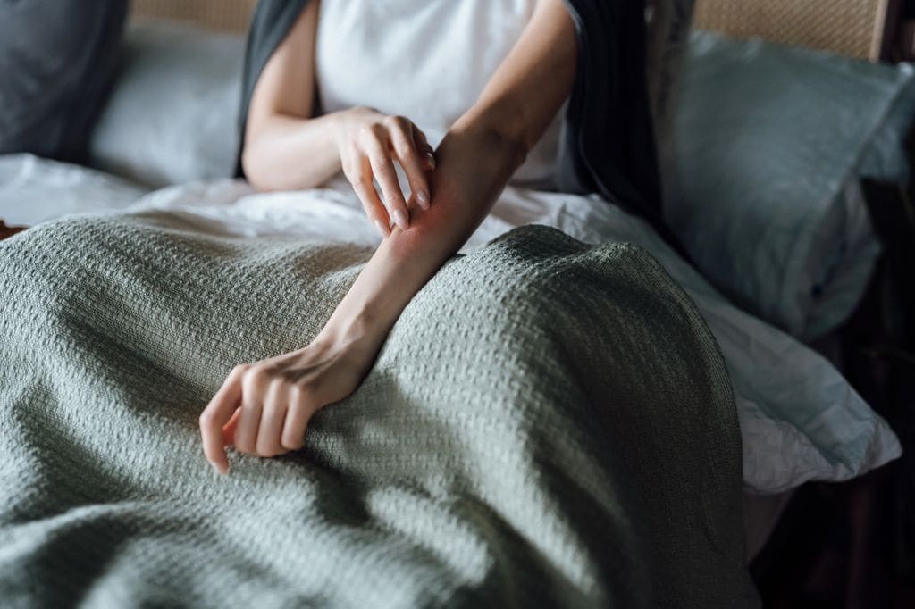 mujer rascándose la piel del brazo en la cama