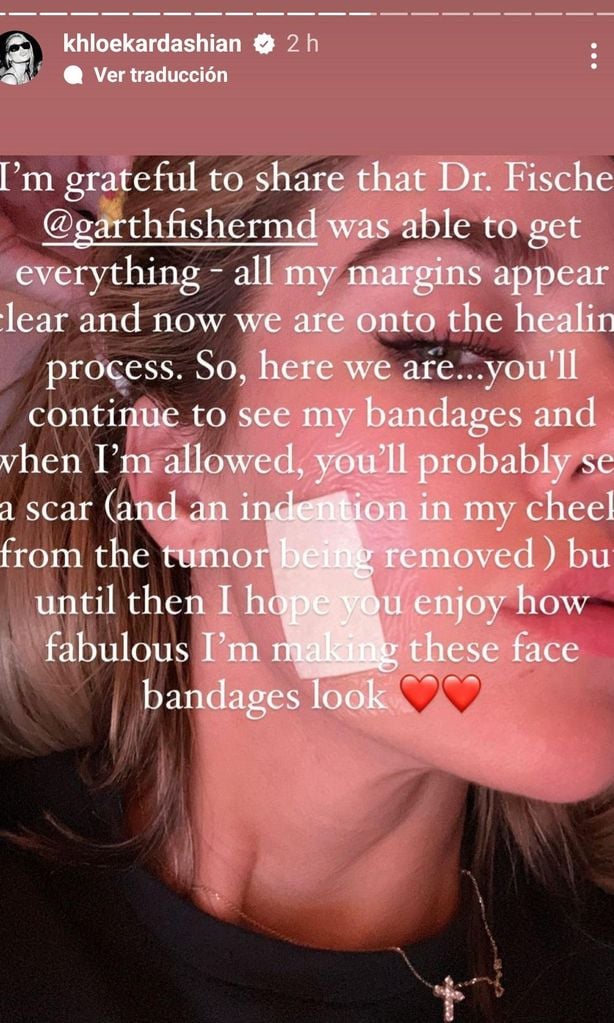 Khloé Kardashian revela que le fue diagnosticado cáncer de piel