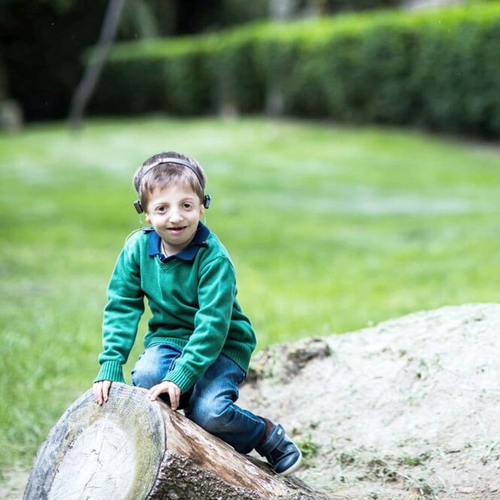 Miguel, un niño con Síndrome de Treacher Collins.